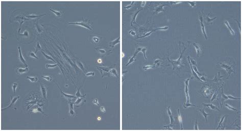 3T3-L1 cell culture 후 지금 이 상태 contamination 인가요??? > BRIC