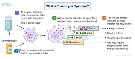 Tumor Lysis Syndrome | ChemoExperts