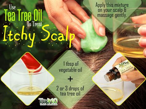 Home Remedies for Itchy Scalp | Top 10 Home Remedies