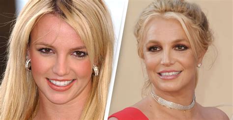 Britney Spears Teeth Before and After - OtakuKart