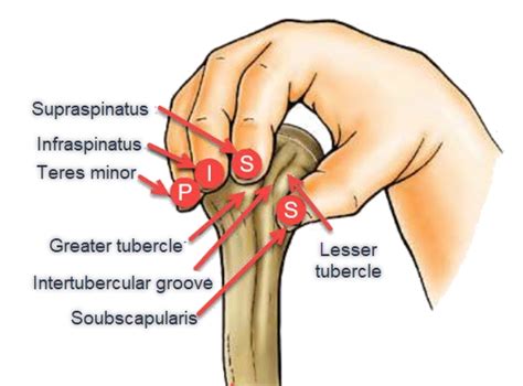 Rotator cuff tear | OsteoMag