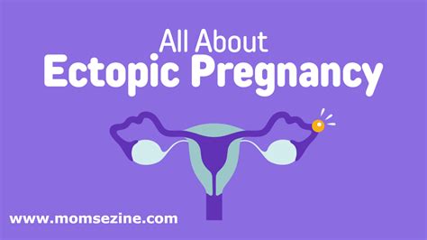 Ectopic Pregnancy: Symptoms, Causes and Best Treatment Options (2023 Updated) | momsezine.com