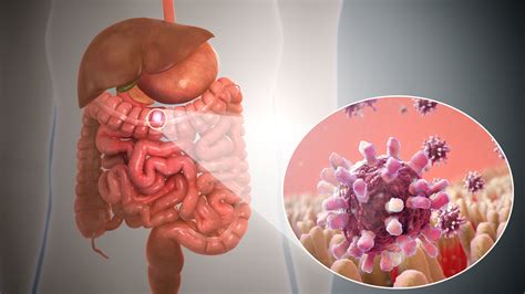 Causes of gastroenteritis | General center | SteadyHealth.com