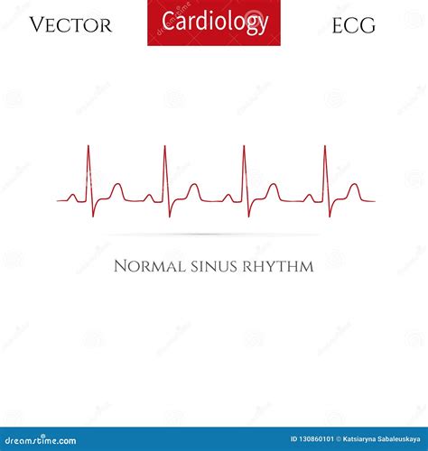 Normal Heart Rhythm Stock Illustrations – 533 Normal Heart Rhythm Stock ...