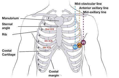 ECG Lead positioning • LITFL • ECG Library Basics