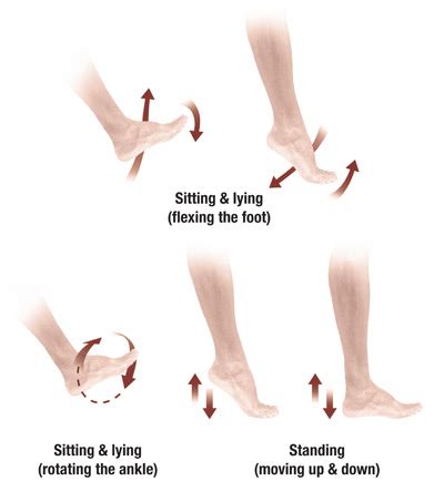 Pulmonary Embolism treatment ~ akufisio.blogspot