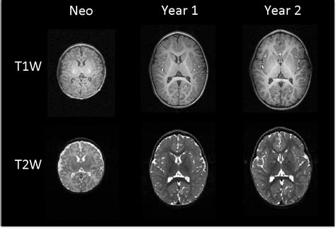 Figure 2 from Modeling Brain Growth and Development | Semantic Scholar