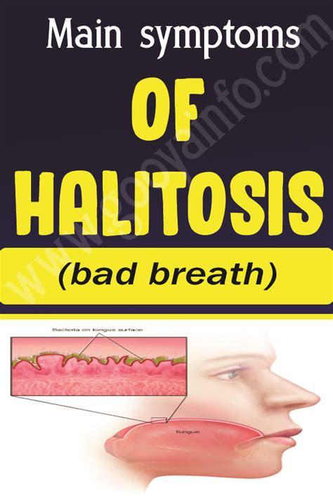 Main symptoms of halitosis (bad breath)