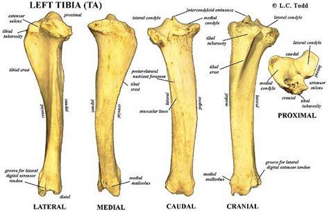 Spines: Tibial Spines Knee