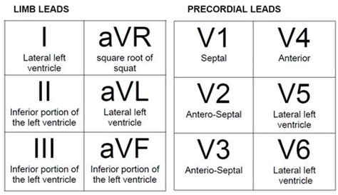 12 leads of ECG Flashcards | Quizlet