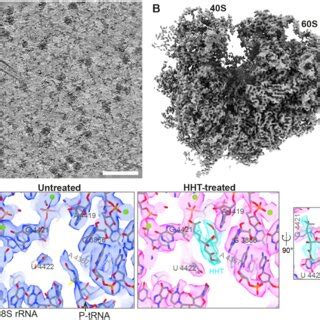 80S ribosome structures in human cells. (A) A tomographic slice from an... | Download Scientific ...