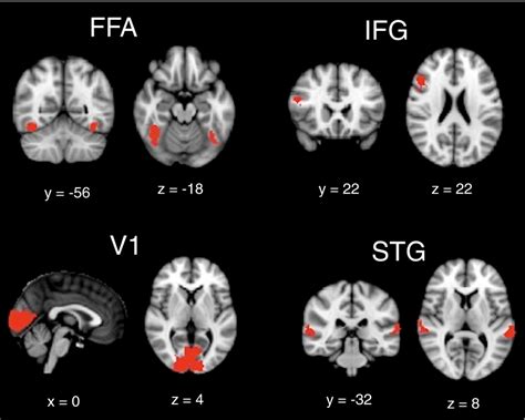 Functional masks of the fusiform face area (FFA), primary visual area ...