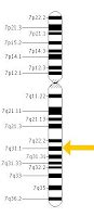 Tahiruddin Tahir: Gene Associated With Multinodular Goiter: SLC26A4 = Pendred syndrome gene ...