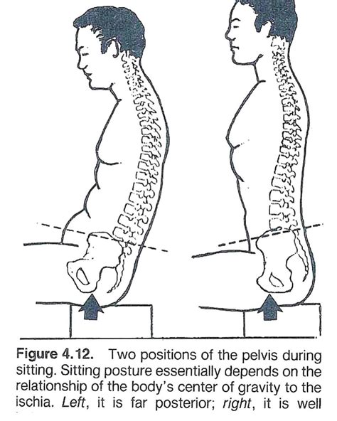 [SITZ BONES] The ischial tuberosity (or tuberosity of the ischium tuber ...