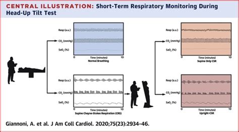 Upright Cheyne-Stokes Respiration in Patients With Heart Failure | Journal of the American ...