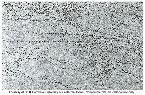 Electron Microscope Dna