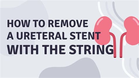 Urethral Stent