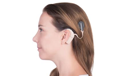 Cochlear Implants - AOPA