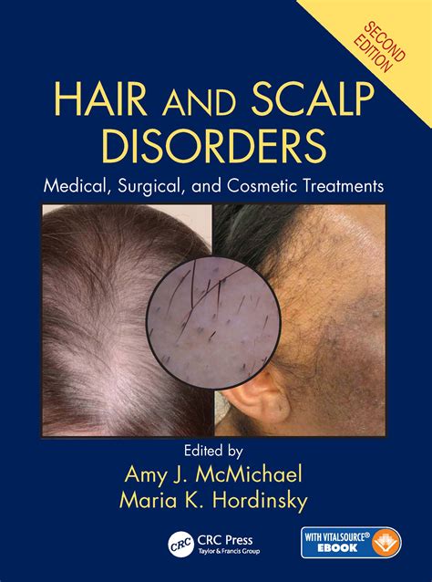 Hair and Scalp Disorders | Taylor & Francis Group