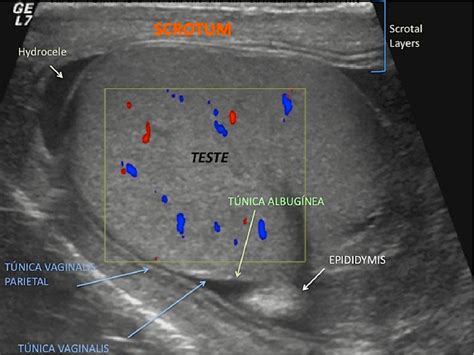 Testicular Anatomy Ultrasound