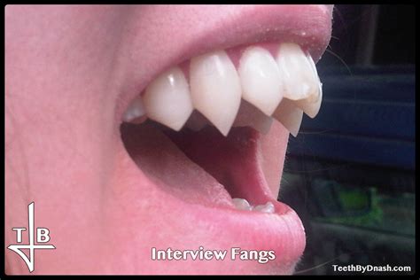 Interview | Teeth By Dnash