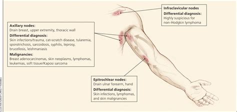 Epitrochlear Nodes