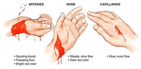 Fr33 Aid lesson: Bleeding Control – fr33aid