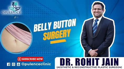 Belly Button Surgery | Dr. Rohit Jain | Opulence Clinic| Gurugram - YouTube