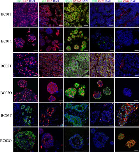 Immunofluorescence analysis of marker expression in parental tumors and... | Download Scientific ...