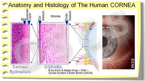 The CORNEA — Ocular Surface Center Berlin