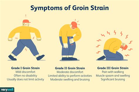 Groin Strain Groin Pain In Athletes Symptoms Causes And Treatment | Images and Photos finder