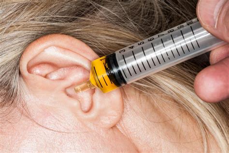 Ear irrigation: Procedure, safety, and side effects