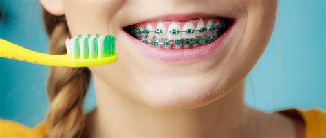 How to Care for Metal Braces | Ann Arbor MI Orthodontist | Dr. Bedi