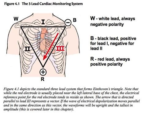 Einthoven's Triangle correlates to 3-lead cardiac monitoring leads | Nursing courses, Cardiac, Nurse