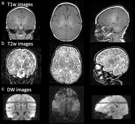 baby mri scan results - Marget Abel