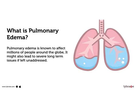 Pulmonary Edema