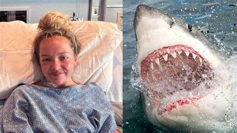 Teenage Girl Survives Shark Attack At Florida Beach