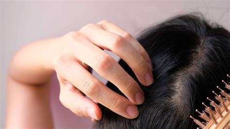 How to Regrow Thinning Hair for Females: Tips and Treatments