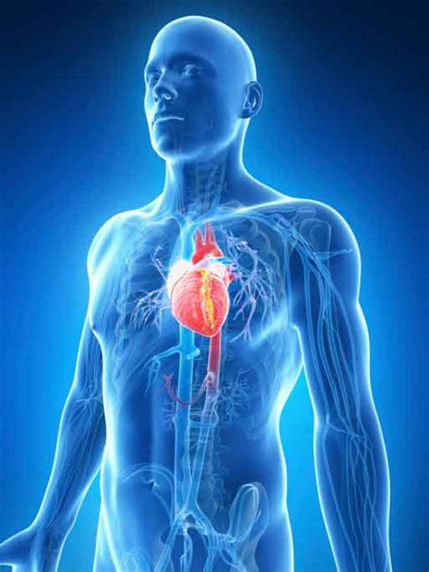 IVC Filter Complications - Migration, Perforation, Fracture