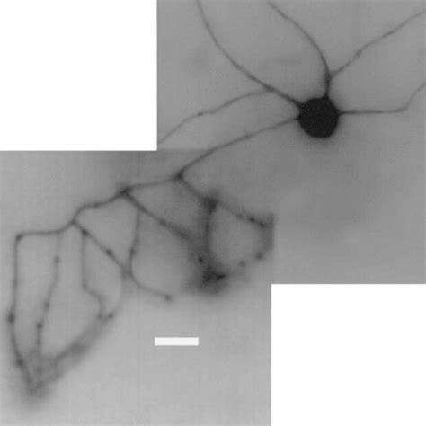 Basket cell morphology. Basket cell identity was confirmed by... | Download Scientific Diagram