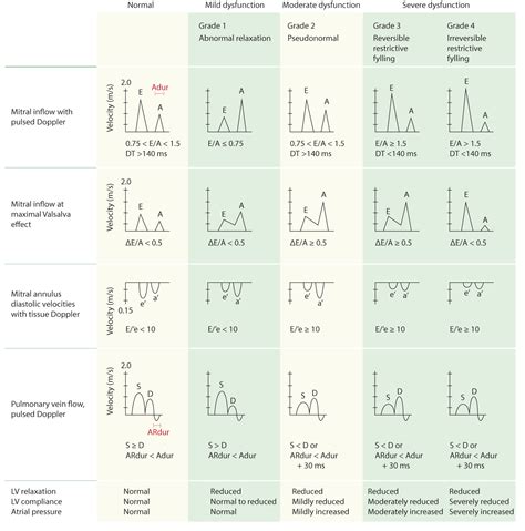 Reference (normal) values for echocardiography – EKG & ECHO