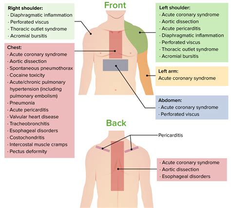 Chest Pain | Concise Medical Knowledge