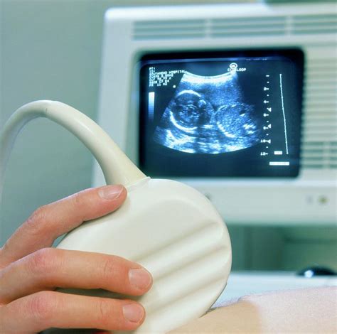 Ultrasound Scanning Of A Pregnant Woman Photograph by Saturn Stills/science Photo Library - Pixels