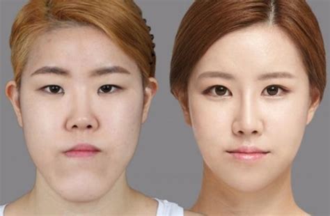 81 photos of plastic surgery in Korea that will make your jaw drop