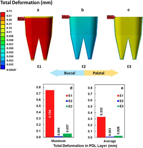 (a-c) PDL deformation distribution over the inner surface the PDL layer ...