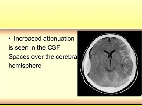 Head injury.ppt