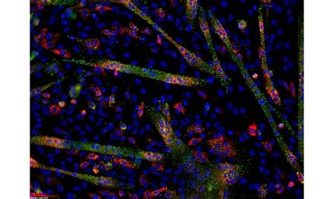 First integrated atlas of microRNA expression in human primary cells