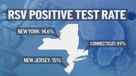 Push for Federal RSV Action Plan as Pediatric Cases Surge – NBC New York