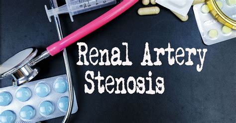 Renal Artery Stenosis - Symptoms, Causes And Treatment