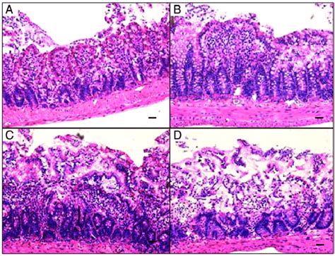 Representative images from 3 independent experiments of H & E staining... | Download Scientific ...